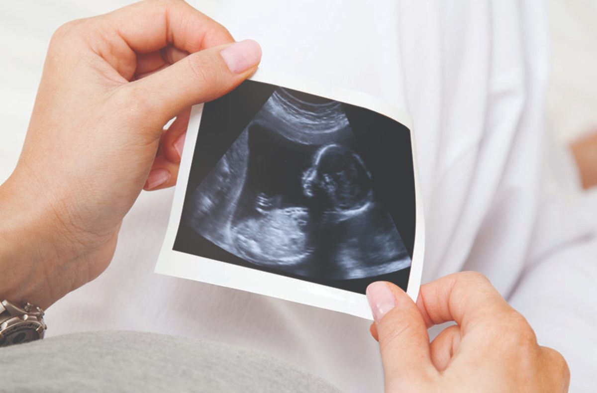 Best Sonography Hospital in Anand, Gujarat