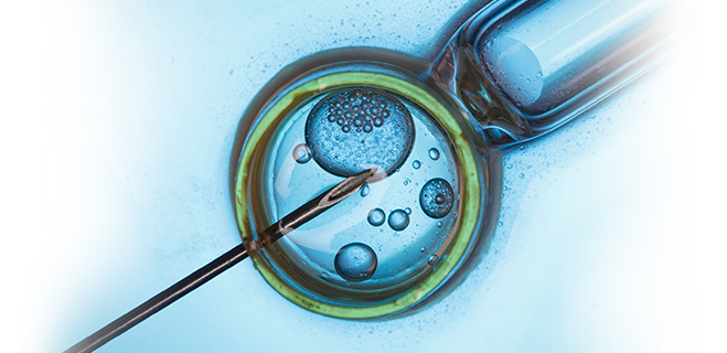 Blastocyst Culture Transfer in Anand, Gujarat,