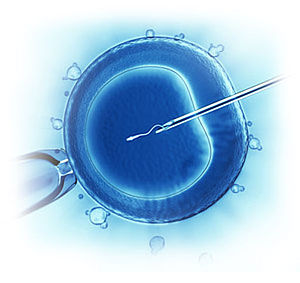 Best ICSI Treatment in Anand, Gujarat